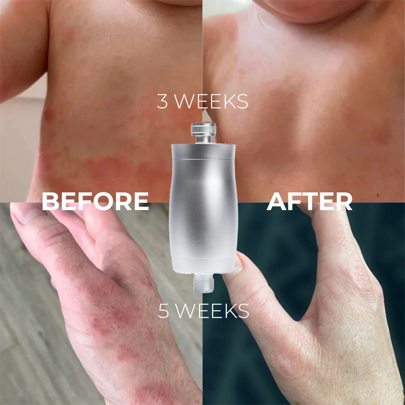 UK Shower Water Is Damaging Your Hair & Skin