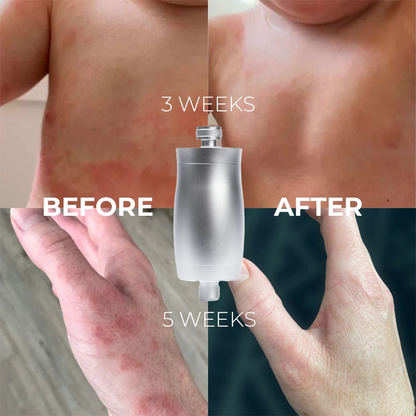 UK Shower Water Is Damaging Your Hair & Skin